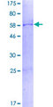 SDCBP2 / Syntenin 2 Protein - 12.5% SDS-PAGE of human SDCBP2 stained with Coomassie Blue