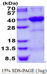 SDCBP2 / Syntenin 2 Protein