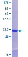 SDCCAG1 / NEMF Protein