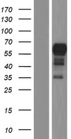 SDCCAG3 Protein - Western validation with an anti-DDK antibody * L: Control HEK293 lysate R: Over-expression lysate