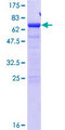 SDCCAG8 Protein - 12.5% SDS-PAGE of human SDCCAG8 stained with Coomassie Blue