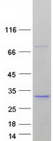 SDF2 Protein - Purified recombinant protein SDF2 was analyzed by SDS-PAGE gel and Coomassie Blue Staining