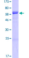 SDF4 Protein - 12.5% SDS-PAGE of human SDF4 stained with Coomassie Blue
