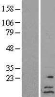 SDHAF4 Protein - Western validation with an anti-DDK antibody * L: Control HEK293 lysate R: Over-expression lysate