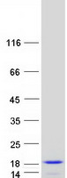 SDHAF4 Protein - Purified recombinant protein SDHAF4 was analyzed by SDS-PAGE gel and Coomassie Blue Staining