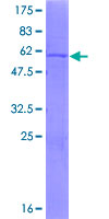 SDHB Protein - 12.5% SDS-PAGE of human SDHB stained with Coomassie Blue