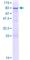 SDR / SDPR Protein - 12.5% SDS-PAGE of human SDPR stained with Coomassie Blue