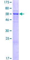 SDR42E1 Protein