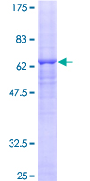 SDR9C1 / BDH1 Protein - 12.5% SDS-PAGE of human BDH1 stained with Coomassie Blue