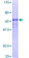 SDR9C1 / BDH1 Protein - 12.5% SDS-PAGE of human BDH1 stained with Coomassie Blue