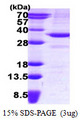 SDR9C1 / BDH1 Protein