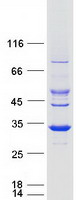 SDR9C7 Protein - Purified recombinant protein SDR9C7 was analyzed by SDS-PAGE gel and Coomassie Blue Staining