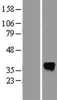 SDS Protein - Western validation with an anti-DDK antibody * L: Control HEK293 lysate R: Over-expression lysate