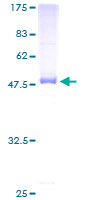 SDS Protein - 12.5% SDS-PAGE of human SDS stained with Coomassie Blue