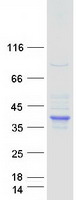 SDS Protein - Purified recombinant protein SDS was analyzed by SDS-PAGE gel and Coomassie Blue Staining
