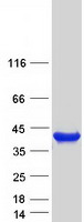 SDSL / Serine Dehydratase-Like Protein - Purified recombinant protein SDSL was analyzed by SDS-PAGE gel and Coomassie Blue Staining