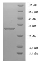SEC11C Protein - (Tris-Glycine gel) Discontinuous SDS-PAGE (reduced) with 5% enrichment gel and 15% separation gel.