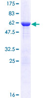 SEC13 Protein - 12.5% SDS-PAGE of human SEC13 stained with Coomassie Blue