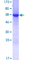SEC13 Protein - 12.5% SDS-PAGE of human SEC13 stained with Coomassie Blue