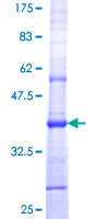 SEC13 Protein - 12.5% SDS-PAGE Stained with Coomassie Blue.