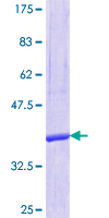 SEC14L2 Protein - 12.5% SDS-PAGE Stained with Coomassie Blue.