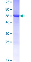 SEC14L4 Protein - 12.5% SDS-PAGE of human SEC14L4 stained with Coomassie Blue