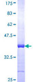 SEC22B Protein - 12.5% SDS-PAGE Stained with Coomassie Blue.