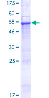 SEC22C Protein - 12.5% SDS-PAGE of human SEC22C stained with Coomassie Blue