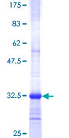 SEC22C Protein - 12.5% SDS-PAGE Stained with Coomassie Blue.