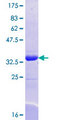 SEC24A Protein - 12.5% SDS-PAGE Stained with Coomassie Blue.
