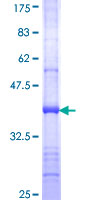 SEC24D Protein - 12.5% SDS-PAGE Stained with Coomassie Blue.