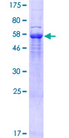 SEC31B Protein - 12.5% SDS-PAGE of human SEC31B stained with Coomassie Blue