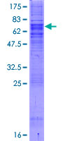 SEC61A1 / SEC61 Protein - 12.5% SDS-PAGE of human SEC61A1 stained with Coomassie Blue