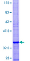 SEC61B Protein - 12.5% SDS-PAGE of human SEC61B stained with Coomassie Blue