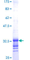 SEC61B Protein - 12.5% SDS-PAGE Stained with Coomassie Blue.