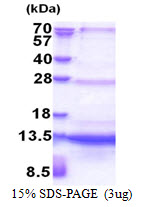 SEC61B Protein