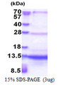 SEC61B Protein