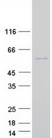 SEC62 / TP-1 Protein - Purified recombinant protein SEC62 was analyzed by SDS-PAGE gel and Coomassie Blue Staining