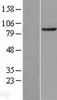 SEC63 Protein - Western validation with an anti-DDK antibody * L: Control HEK293 lysate R: Over-expression lysate