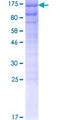 SEC63 Protein - 12.5% SDS-PAGE of human SEC63 stained with Coomassie Blue