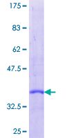 Secretin Protein - 12.5% SDS-PAGE of human SCT stained with Coomassie Blue