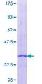 Secretin Protein - 12.5% SDS-PAGE of human SCT stained with Coomassie Blue