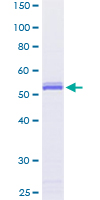 Securin / PTTG1 Protein - 12.5% SDS-PAGE of human PTTG1 stained with Coomassie Blue
