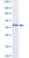 Securin / PTTG1 Protein - 12.5% SDS-PAGE of human PTTG1 stained with Coomassie Blue