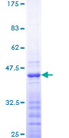Securin / PTTG1 Protein - 12.5% SDS-PAGE Stained with Coomassie Blue
