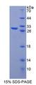 Securin / PTTG1 Protein - Recombinant Pituitary Tumor Transforming 1 By SDS-PAGE