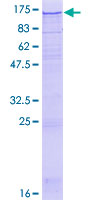 SEL1L3 Protein - 12.5% SDS-PAGE of human KIAA0746 stained with Coomassie Blue