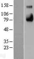SELE / CD62E / E-selectin Protein - Western validation with an anti-DDK antibody * L: Control HEK293 lysate R: Over-expression lysate