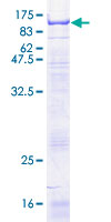 SELE / CD62E / E-selectin Protein - 12.5% SDS-PAGE of human SELE stained with Coomassie Blue