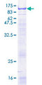 SELE / CD62E / E-selectin Protein - 12.5% SDS-PAGE of human SELE stained with Coomassie Blue